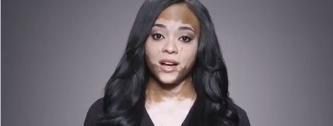 actu_20805_vignette actu_20805_vignette