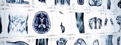 actu_26781_vignette_alaune actu_26781_vignette_alaune