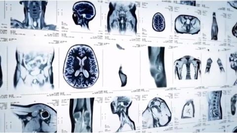 actu_26781_vignette_alaune