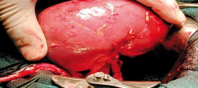 actu_28240_vignette_alaune actu_28240_vignette_alaune