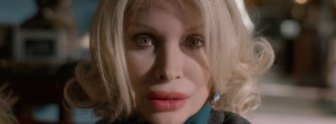 Chirurgie-esthétique LPG contre la chirurgie esthétique