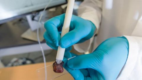 5 news tech journee iloveimg-compressed MasSpec Pen