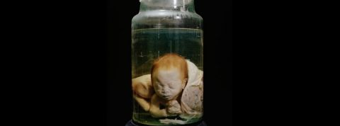 bebe dans du formol
