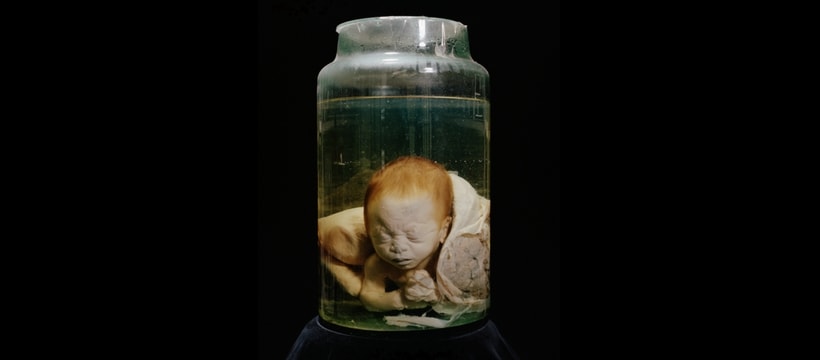 bebe dans du formol