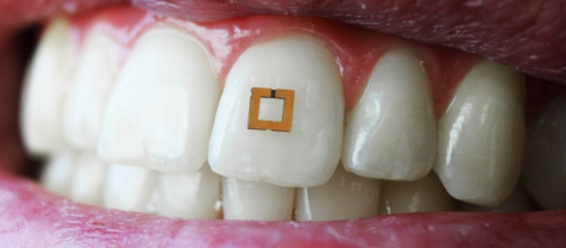 dents dents