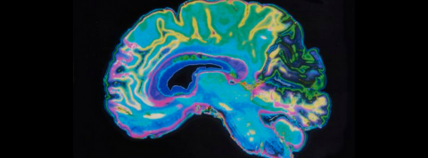 implant cerveau augmenté