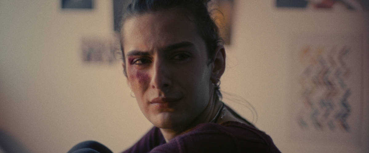 La campagne de sensibilisation de l'Inter-LGBT Une fille transgenre avec un bleu sur le visage
