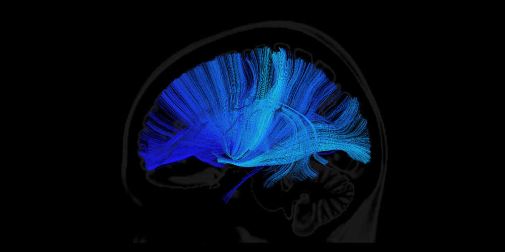 image bleue d'un cerveau