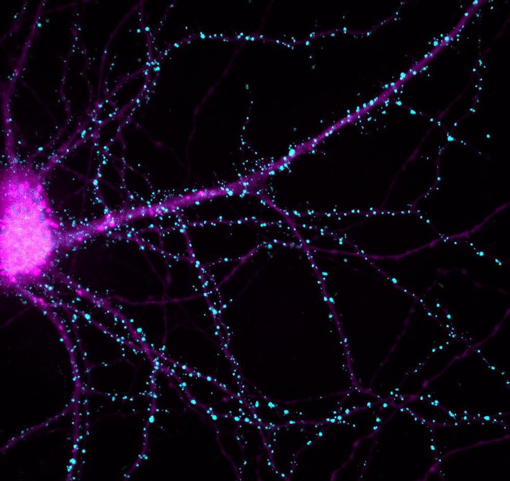 image violette du cerveau