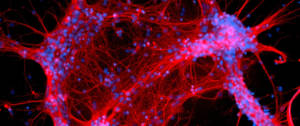 une image de neurones rouges