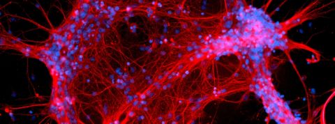 Interstellate - Caitlin Vander Weele une image de neurones rouges