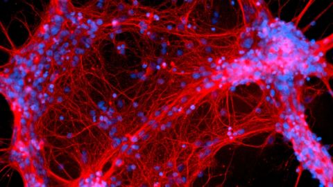 une image de neurones rouges