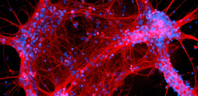 Interstellate, quand la recherche transforme votre cerveau en oeuvre d'art