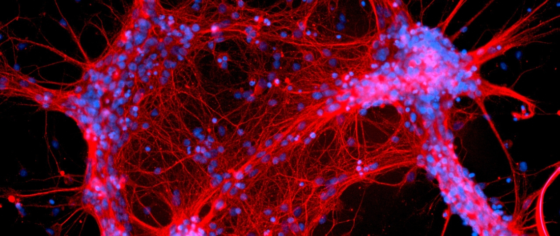 Interstellate - Caitlin Vander Weele une image de neurones rouges