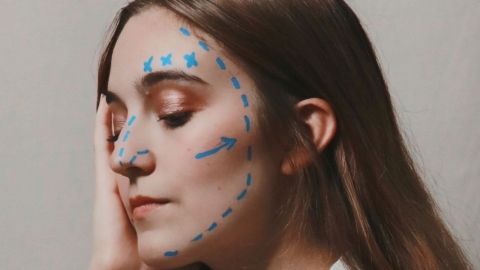 Une femme avec du crayon sur le visage comme avant une opération chirurgicale