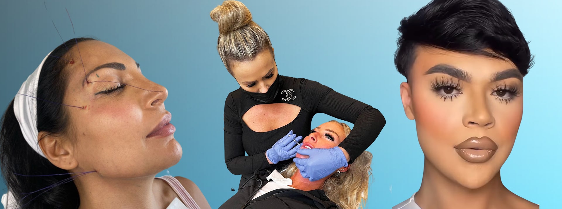 Botox et chrurgie esthétique