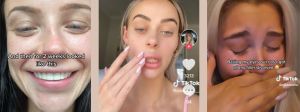 Comptes TikTok d'influenceuses ayant eu recours à un lip dissolving
