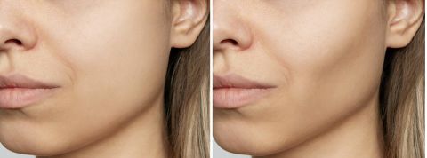 Body as a project Body as a project